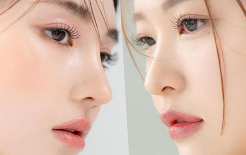 Cách làm mũi cao tại nhà: phương pháp phổ biến và điều cần biết
