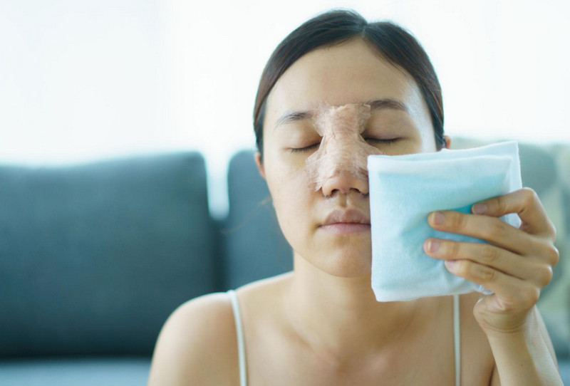 Tuổi thọ của nâng mũi bao lâu? So sánh độ bền theo từng phương pháp