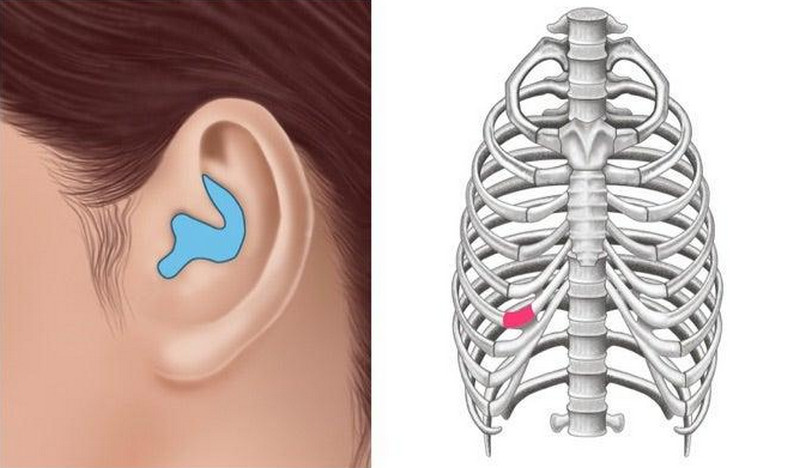 Nâng mũi cấu trúc là gì? Ưu nhược điểm, quy trình, chi phí và ai phù hợp 